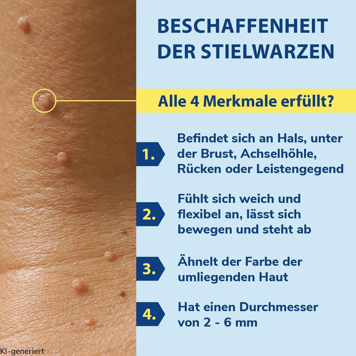 Hautbereich mit kleinen erhabenen Stielwarzen-Punkten, nah und gut sichtbar