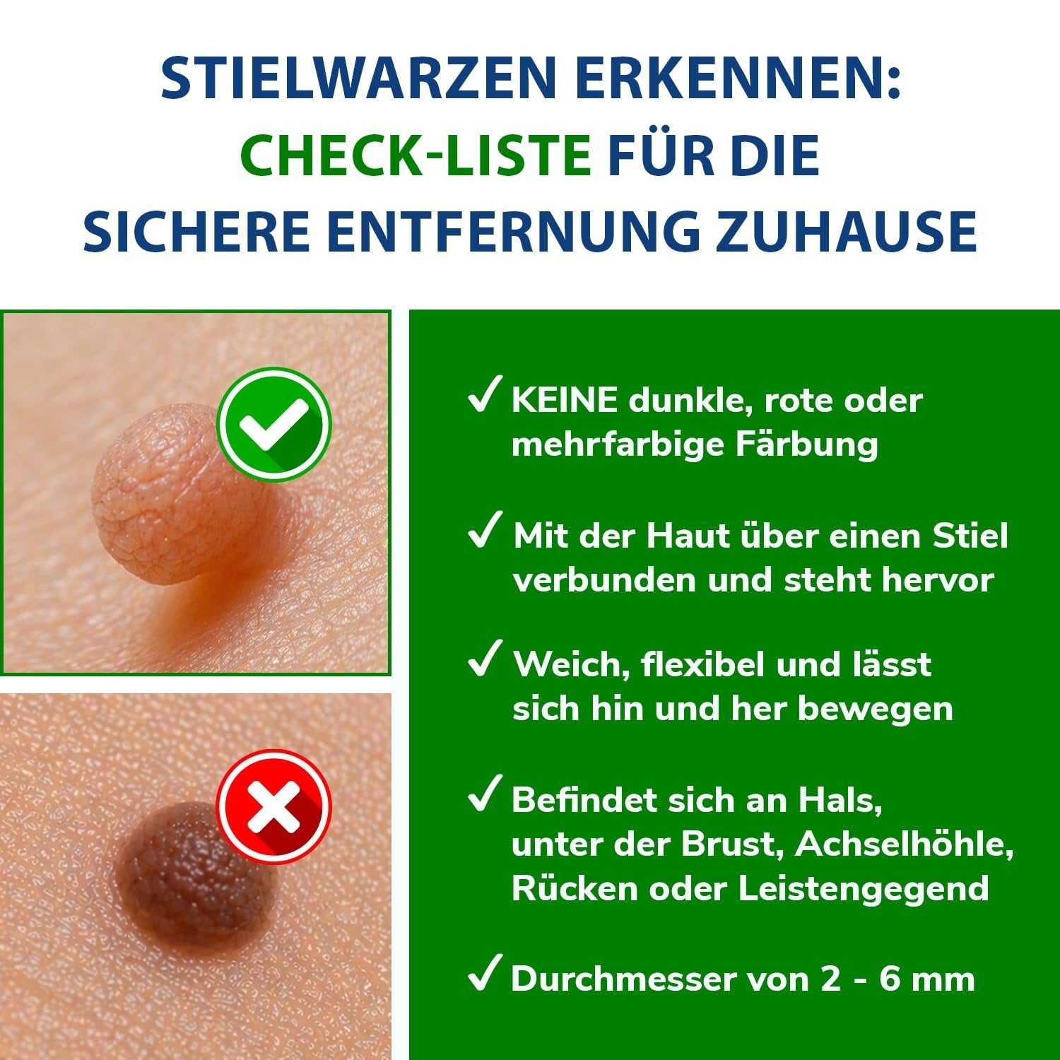 tetesept Stielwarzen Entferner Set